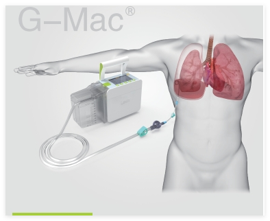 樂(lè )信 胸腔引流監控系統 G-Mac